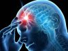 شناخت شوک عصبی: نشانه ها، درمان و کنترل
