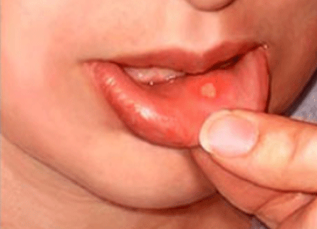 چرا آفت مي‌زنيم؟ محرکش چيست؟ درمانش چيست؟