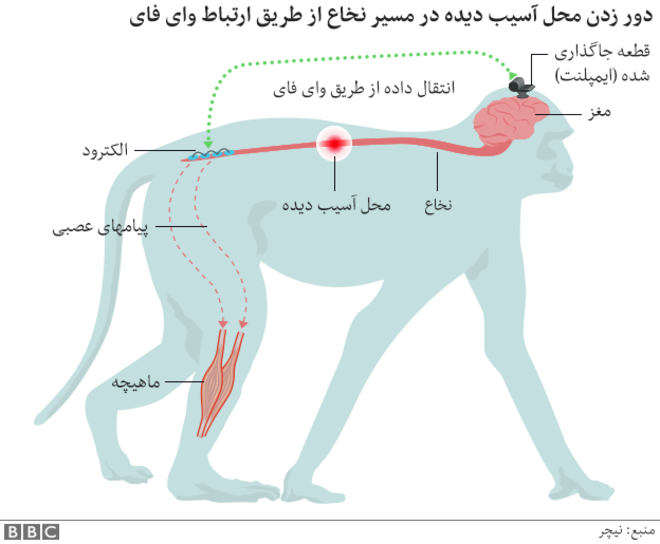 روشی که بیمار قطع نخاعی را می‌تواند مداوا ‌کند
